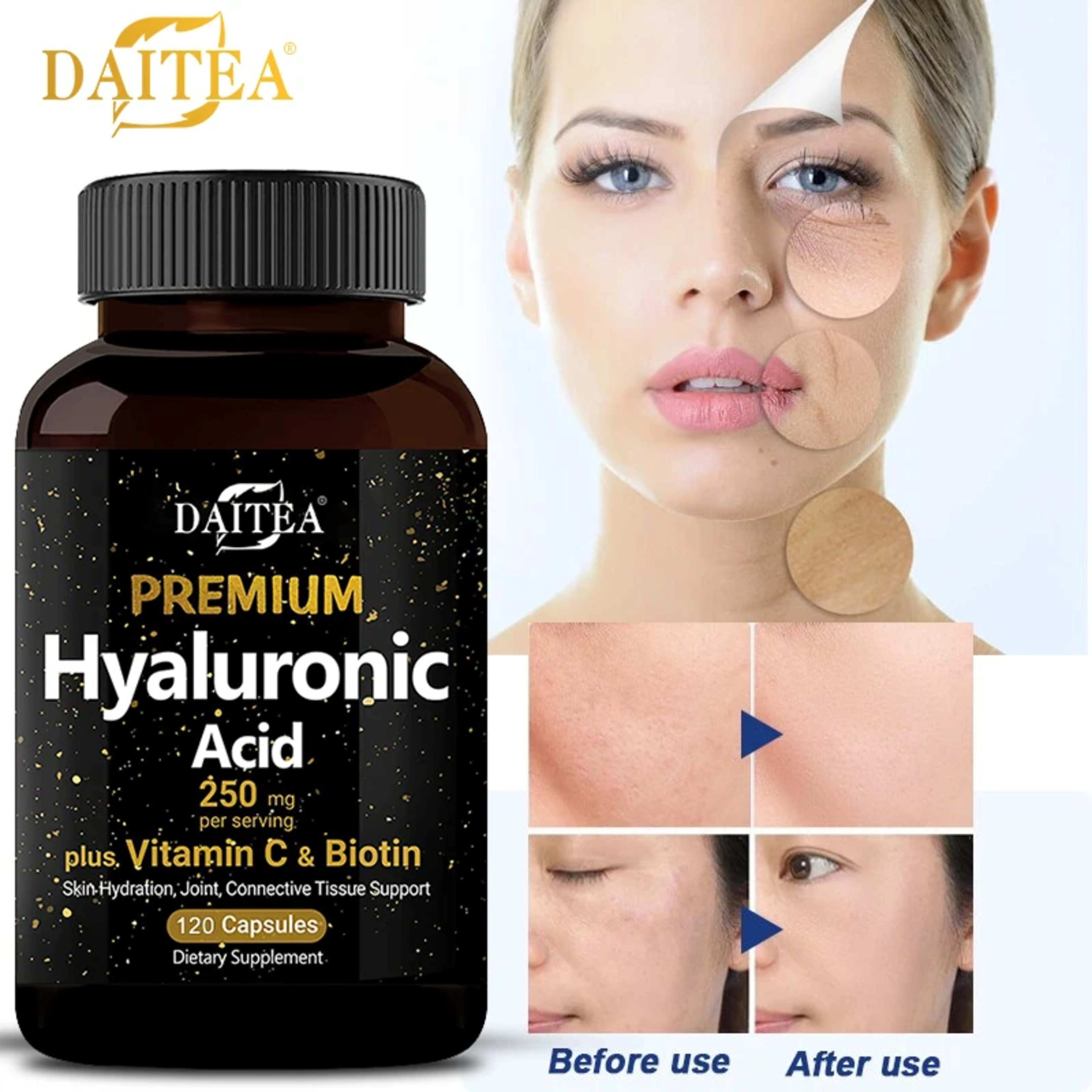 Hyaluronic Acid  Supplement | Contains Vitamin C and Biotin, Skin Moisturizing, Maintain Joint Health, Promote Hair Grow 3