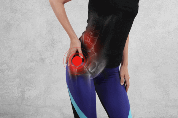 Hyperbarics effective against Avascular Necrosis (AVN) - Osteonecrosis