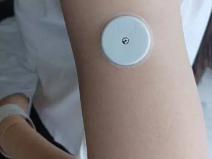 В Удмуртии беременные с диабетом получат современные системы мониторинга сахара