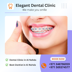 When Should You Visit an Orthodontist for Teeth Alignment