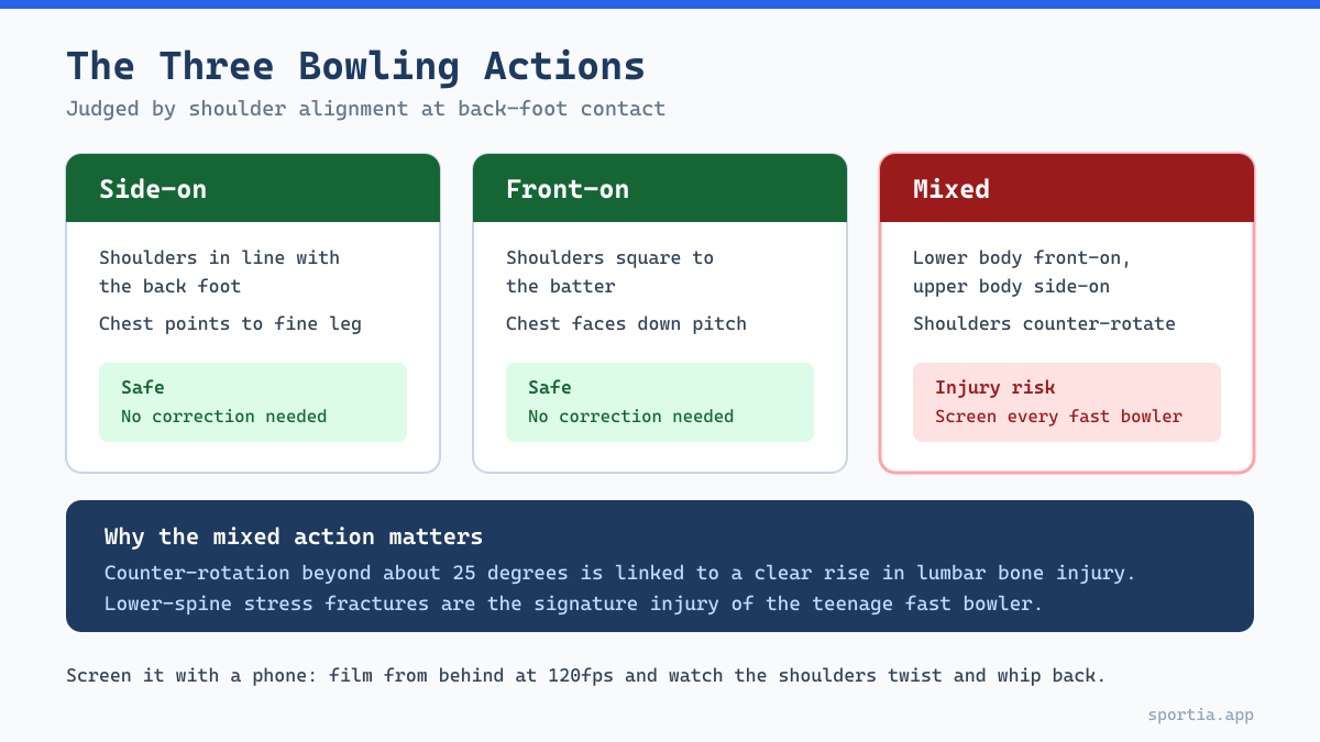 Diagram of side-on, front-on and mixed cricket bowling actions and counter-rotation injury risk