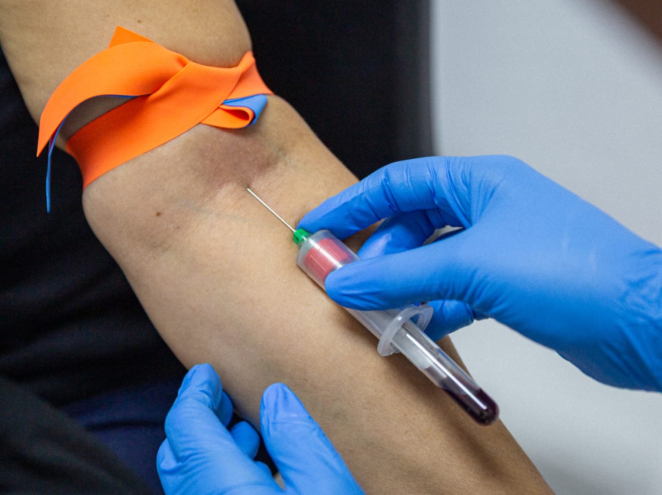 Phlebotomy blood draw