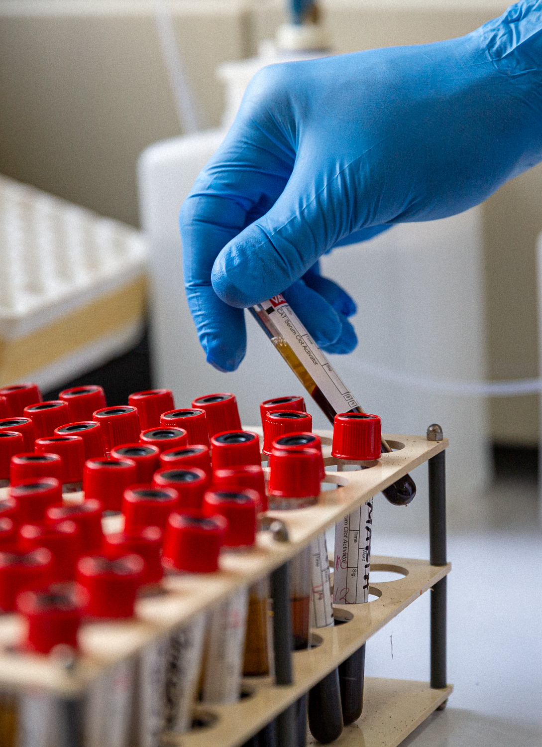 Blood sample diagnostic testing