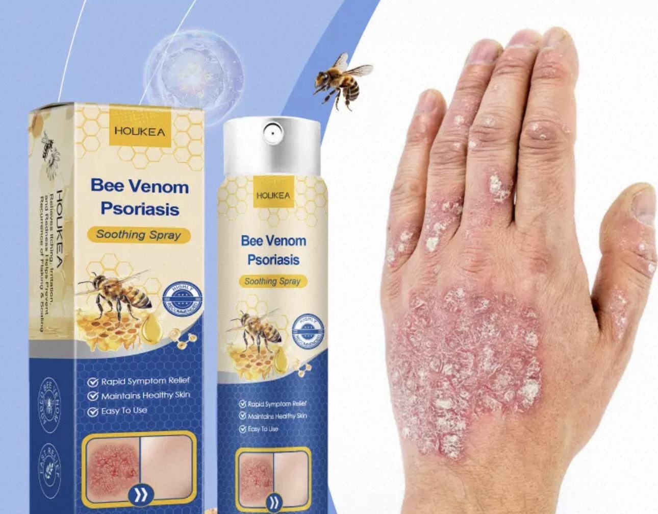 Crema para Psoriasis