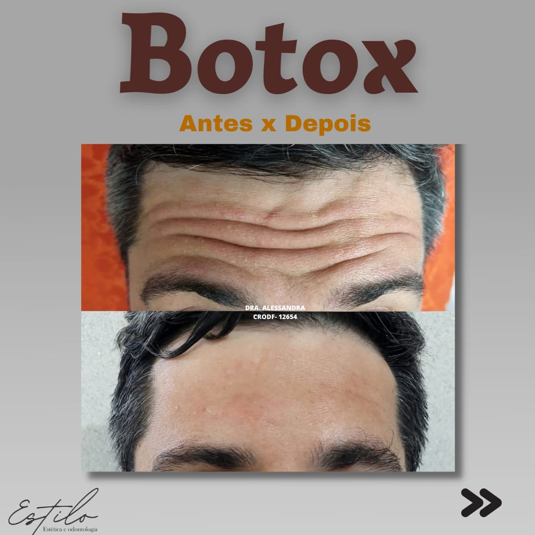 Estilo estética e odontologia