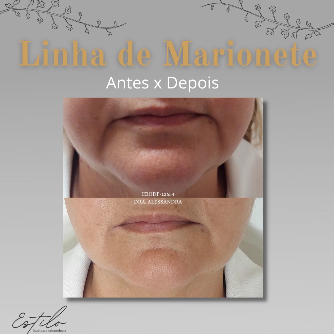 Estilo estética e odontologia — foto 3