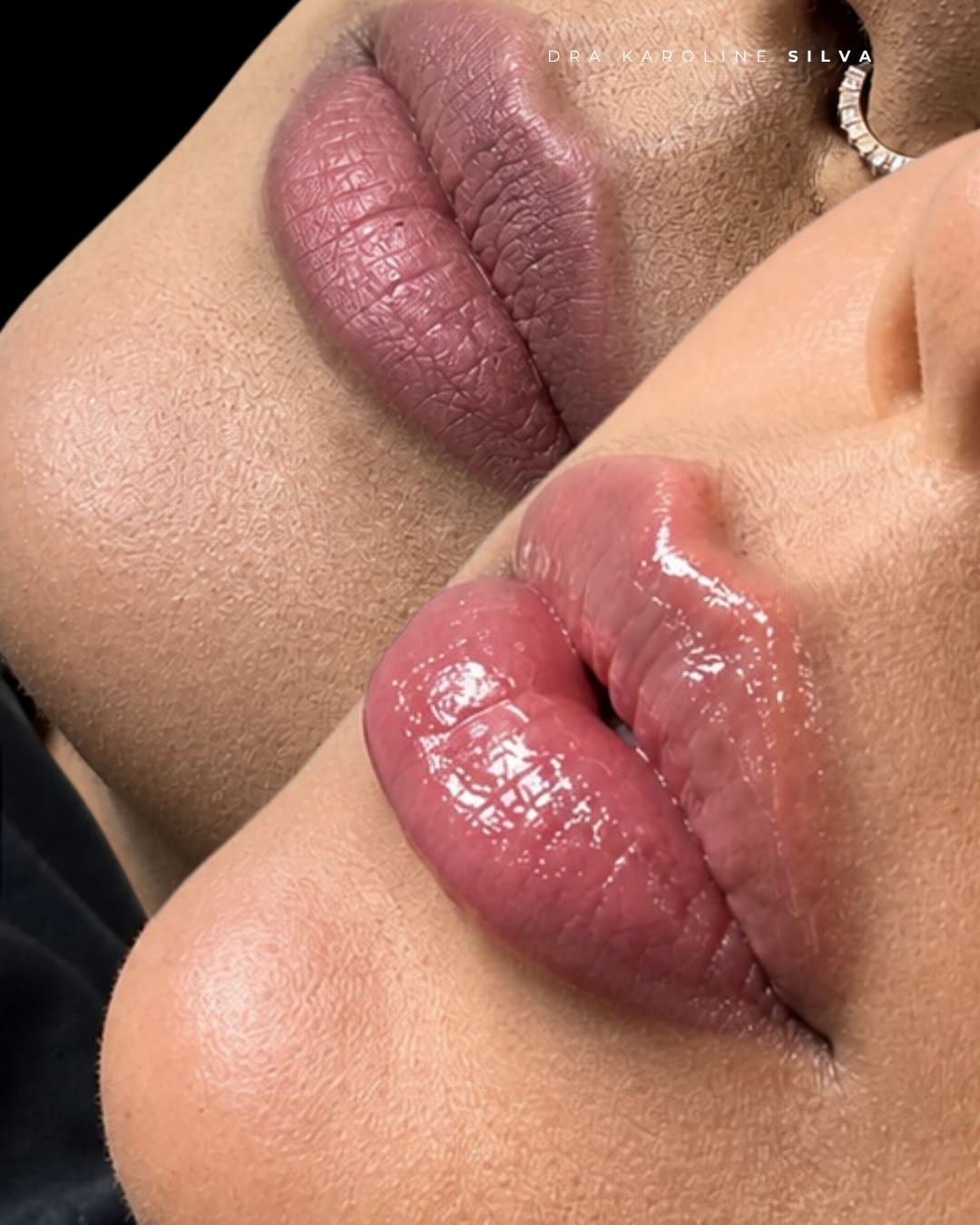 Dra Karoline Silva Estética Avançada — foto 2