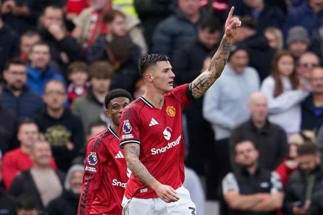 Benjamin Sesko cedera lutut