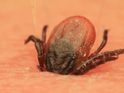 770 жителей Кировской области пострадали от укусов клещей