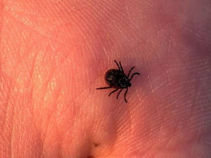 Валера, остановись: в Кировской области свыше десяти человек заболели энцефалитом