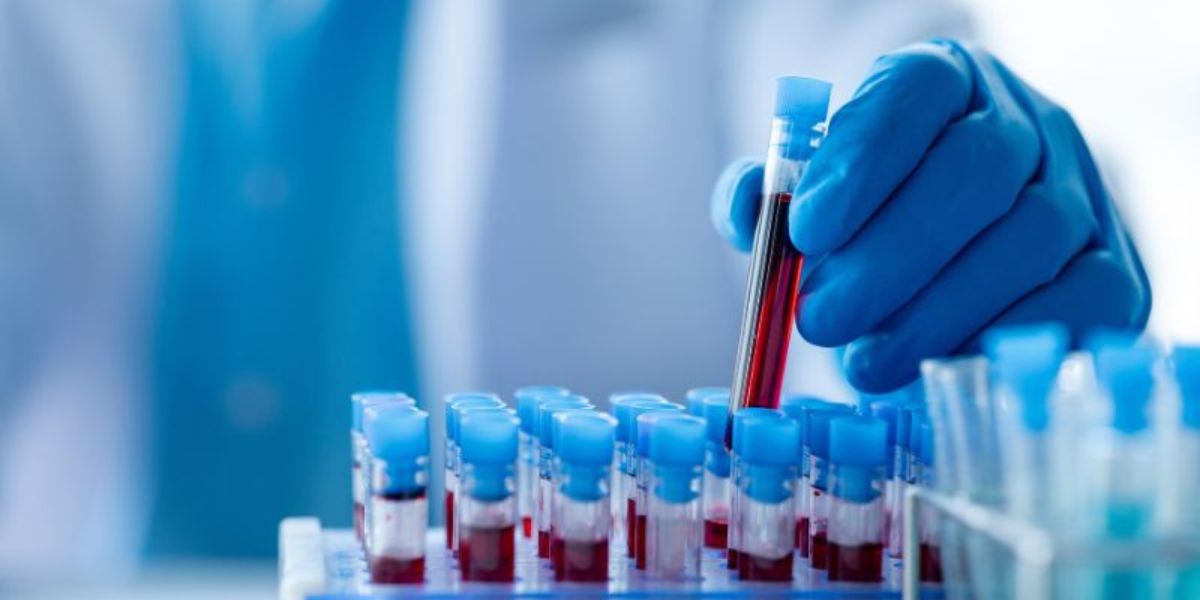 How Early Does a Blood Test Detect Pregnancy? | Walk in Clinic