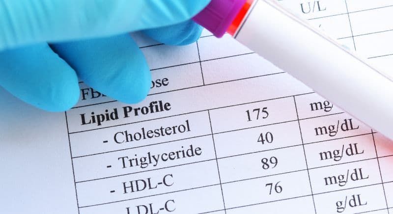 When Should You Check Cholesterol? | UK Screening Age Guide | Private ...