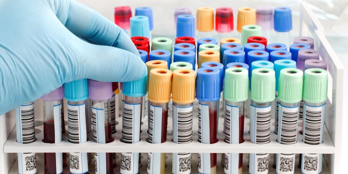 Visual Blood Testing Take Control of Your Health with Private Blood Screening | Walk in Clinic