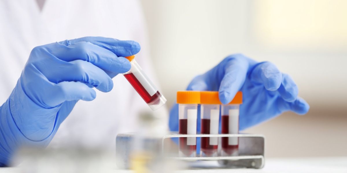Diabetes Screening: A Key Part of Your Annual Check-Up | Walk in Clinic