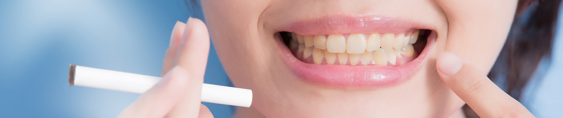 Emergency Crown Placement: A Quick Guide to Dental Recovery - Restorative Dentistry article