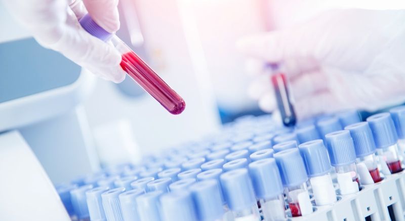 Navigating Hormone and Metabolic Imbalances: When to Ask for Targeted Blood Panels