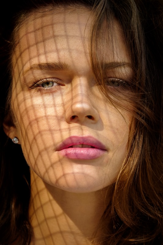 Skin Boosters for Melasma and Sun-Damaged Skin: Cellular Repair Protocols