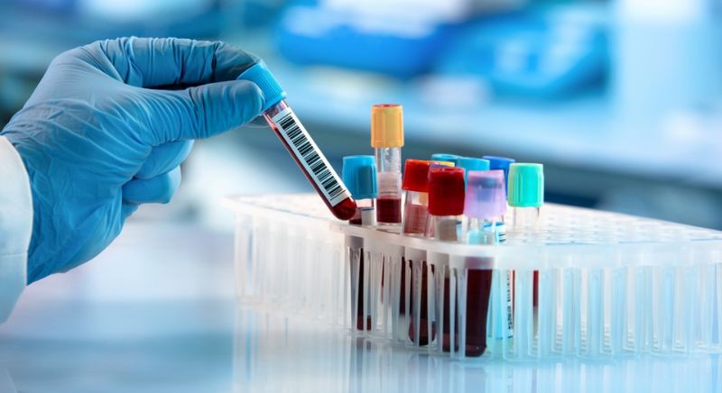 Preparing for Your Visit: Do You Need to Fast Before Brain Health Blood Tests?