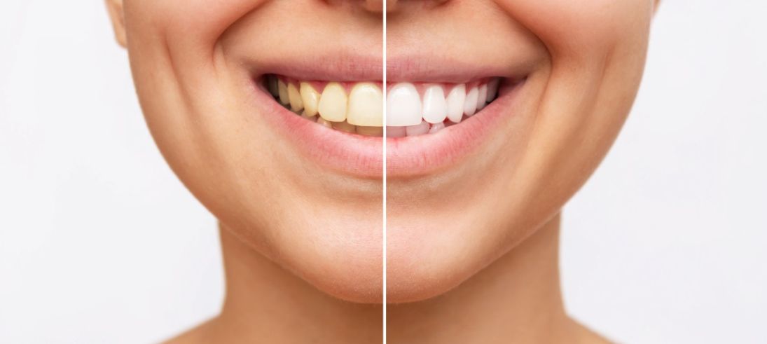 The Safety of Nanomaterials in Modern Whitening Agents
