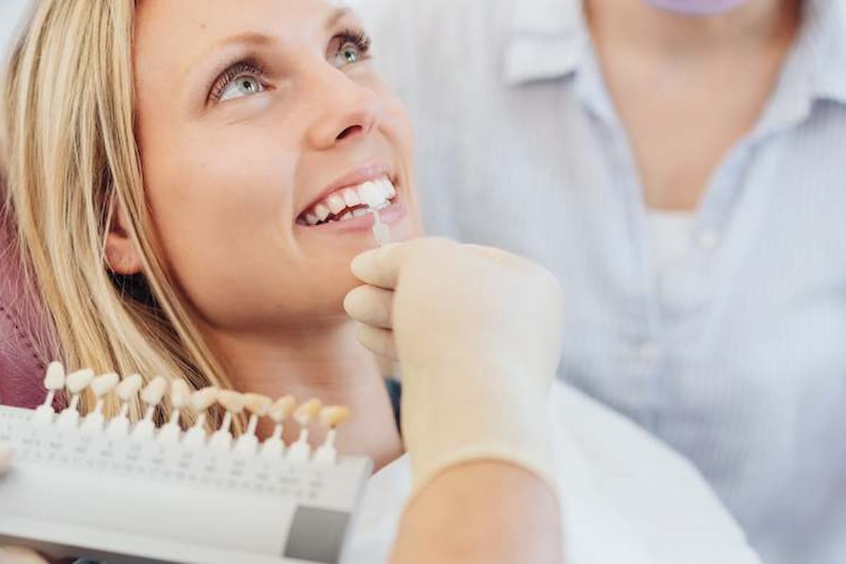 Porcelain Veneers: The Ultimate Smile Transformation Guide