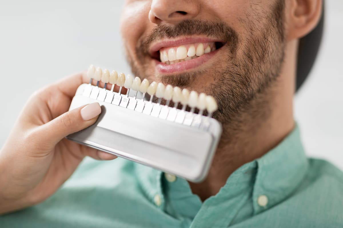 Can Porcelain Veneers Repair Chipped Front Teeth For Patients?