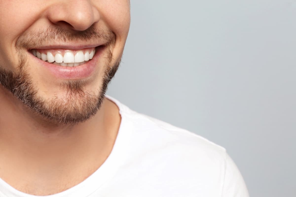 Do Composite Veneers Require Removal Of Natural Tooth?