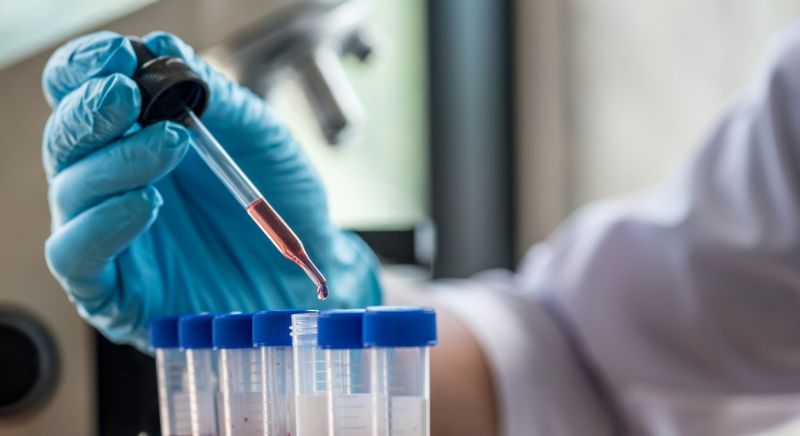 How to Choose a Health Screening Level That Fits Your Needs