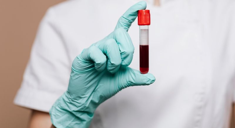 Why Your GP Recommends Early Blood Testing: Navigating Diagnostic Care in Central London