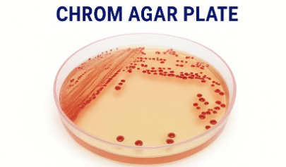 Chrom Agar Plates for UTI  Plates