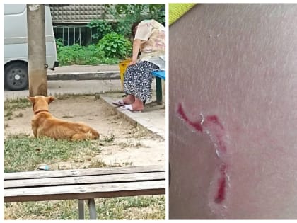 Собака напала на ребенка на детской площадке в Севастополе