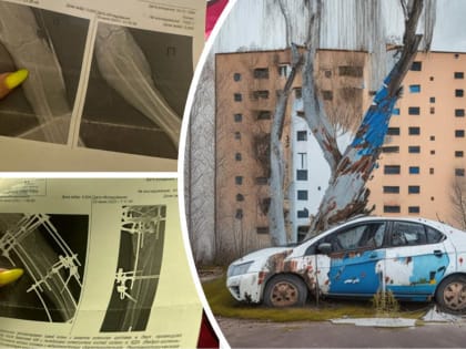 Ярославца подозревают в умышленном наезде на бывшую гражданскую жену