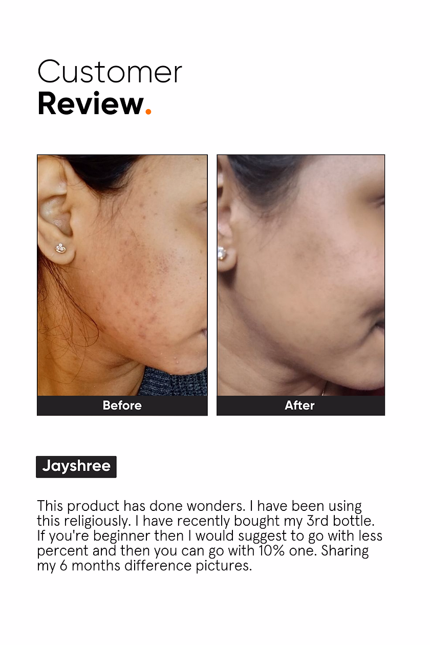 Minimalist Niacinamide Serum vanijay5