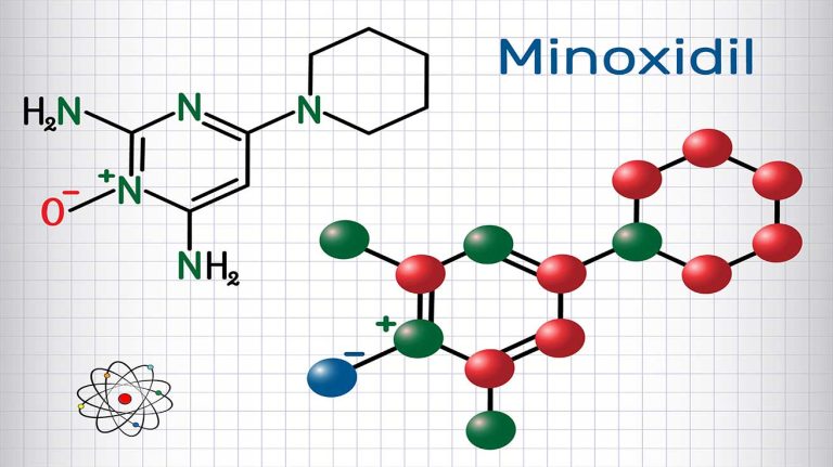  Minoxidil and hair transplant