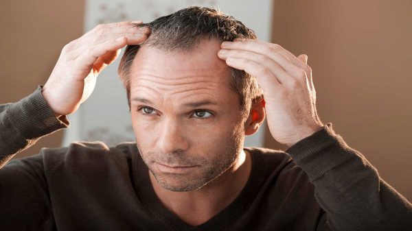 Solutions to prevent hair loss ?