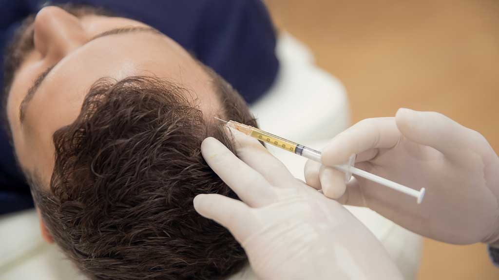 PRP terapie po transplantaci vlasů: podpora opětovného růstu?