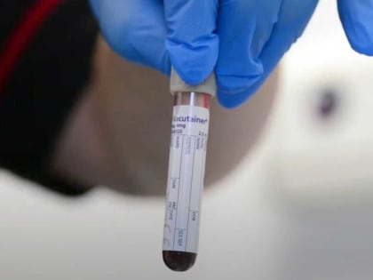 Доктор Мясников рассказал, за что на самом деле отвечает группа крови и как она влияет на нашу жизнь — научно доказанный факт