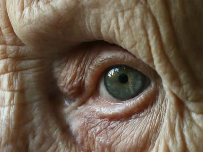 Этот простой напиток может предотвратить катаракту в любом возрасте: совет от врача