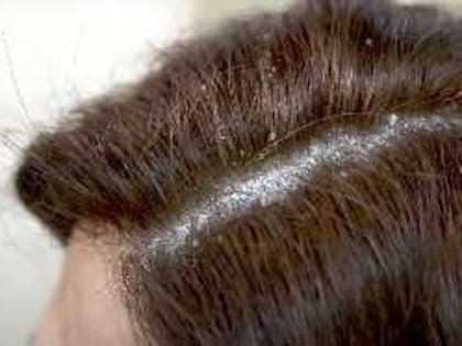 Пигментные пятна, широкие поры и глубокие морщины сократятся на 50%: Доктор Голубев поделился рецептом красоты — достаточно даже одной процедуры