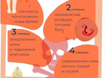 Сегодня за окном настоящий мороз! Не забывайте о правилах безопасности. Изучите памятку МЧС России, прежде чем выходить на улицу.