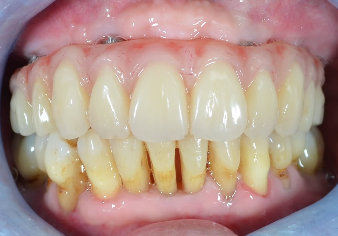 After · close-up — case 1
