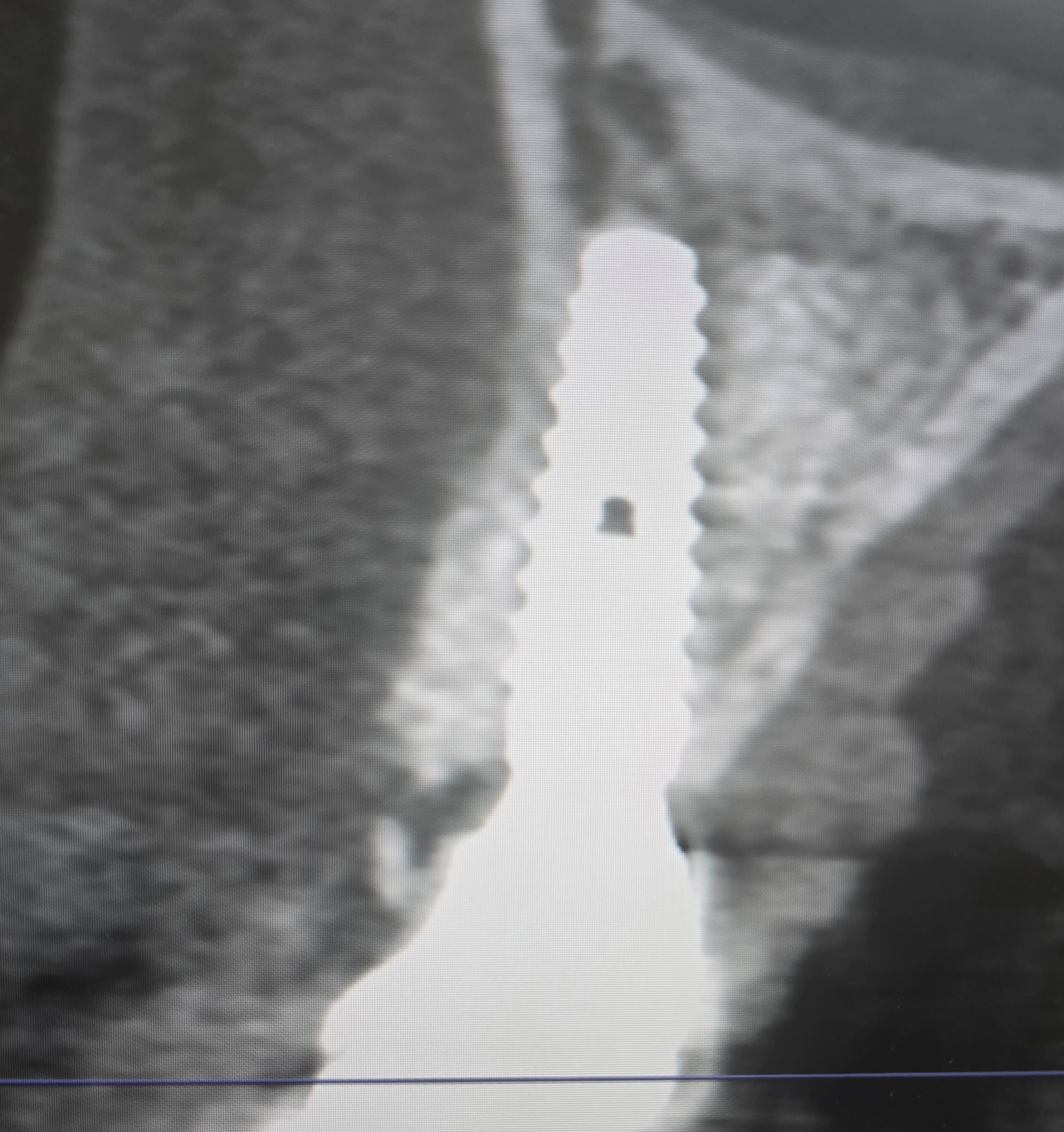 CBCT scan — case 2