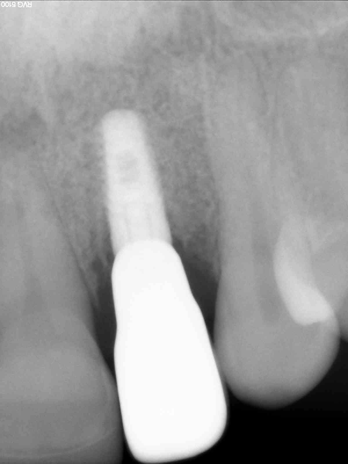 X-ray (10-year) — case 3