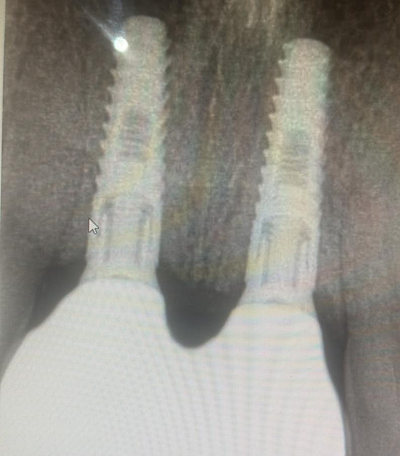 X-ray — case 6
