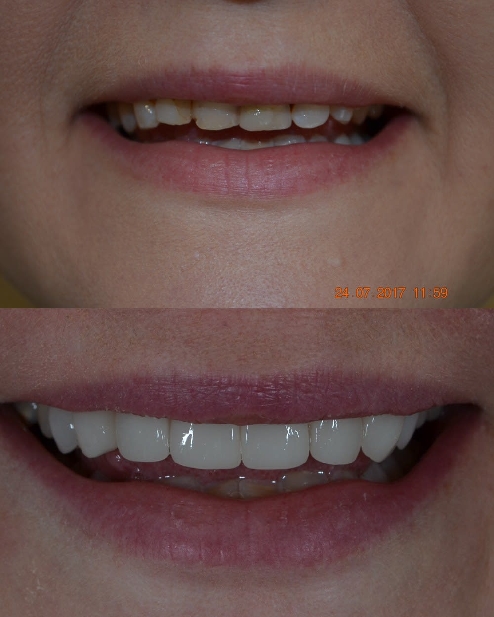 Same Day Smile — Cosmetic case photo from our practice