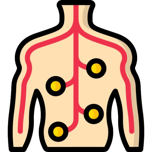 Nerve Compression