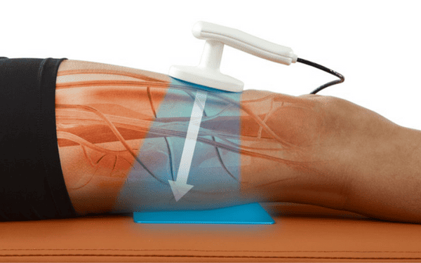 TECAR (Transfer of Energy Capacitive and Resistive) Therapy