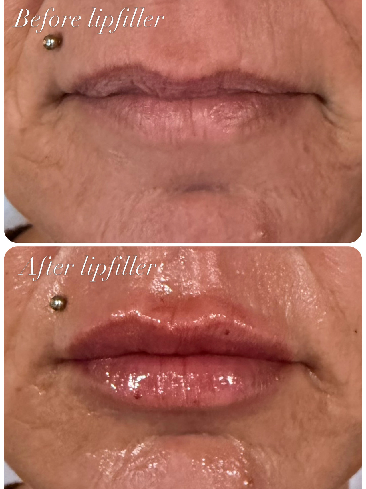 Esthetische behandelingen met een natuurlijk resultaat