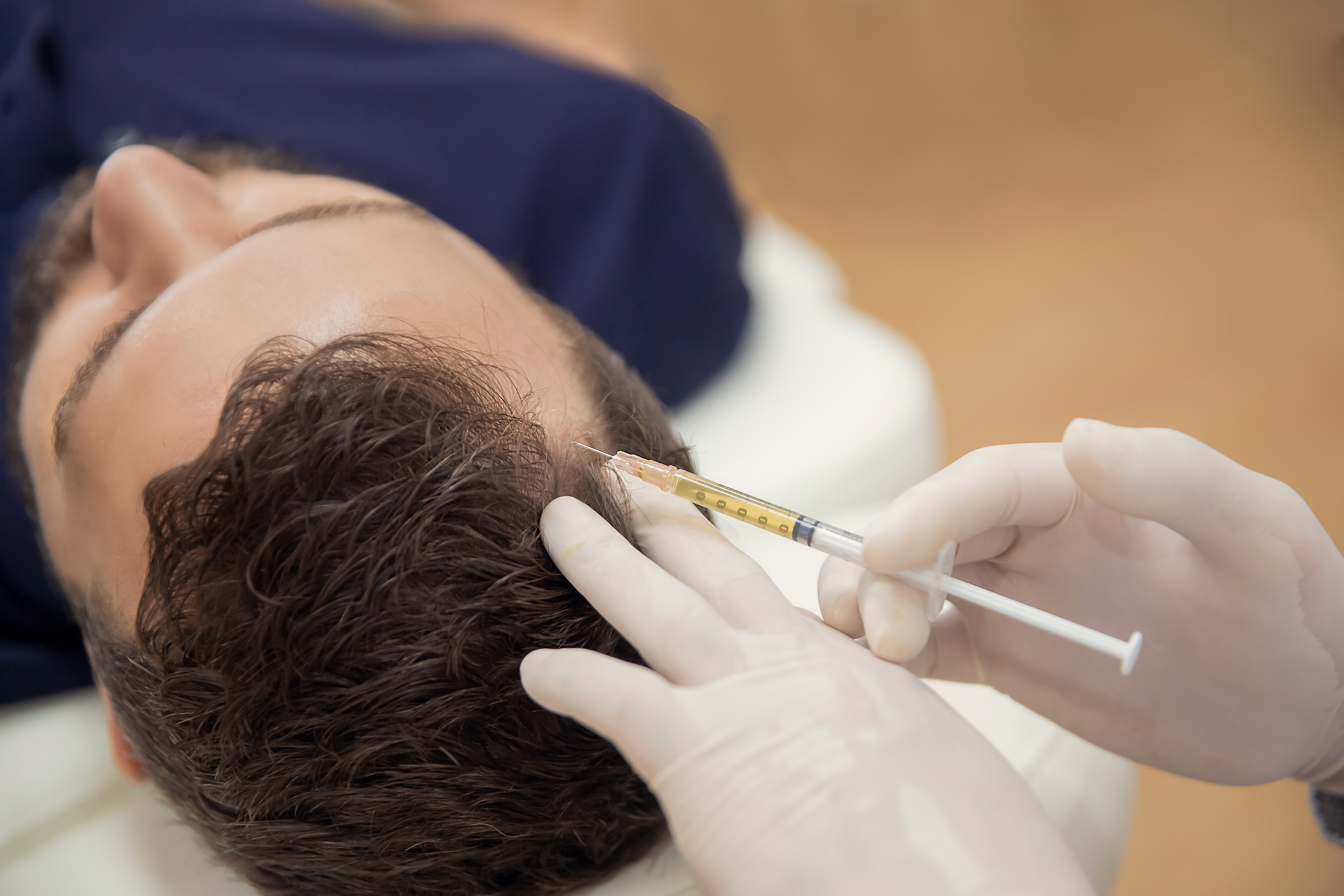 Haar mesotherapie