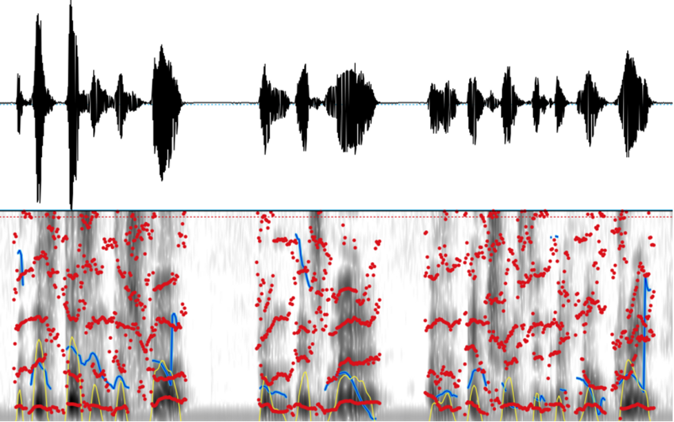 voice analysis