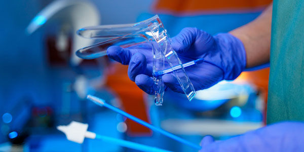 Tindakan Pap Smear